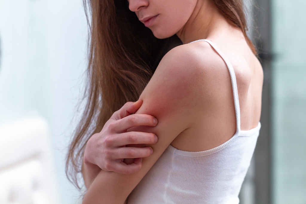 Girl Itching Eczema