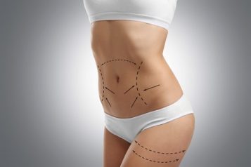 Interesting Information About Liposuction Surgery