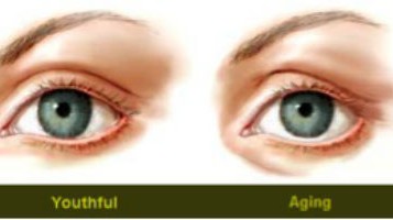 Thoughts On The Shape Of The Youthful Eye And Its Importance In Cosmetic Eyelid Surgery