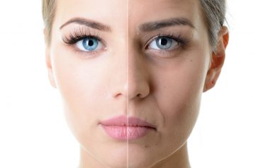 Which Type Of Facelift Is Right For You?