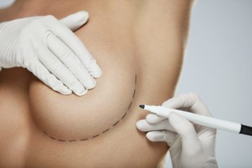 Dr. Preminger Answers Common Questions Regarding Breast Procedures