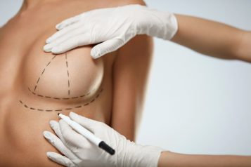 Dr. Clayton Moliver Dishes On His Most Requested Breast Procedures