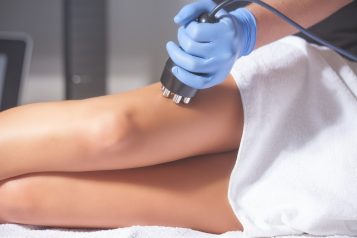 Dr. Hanz Dishes On The Best Treatment For Cellulite