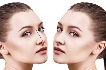 Cosmetic Rhinoplasty For Men And Women