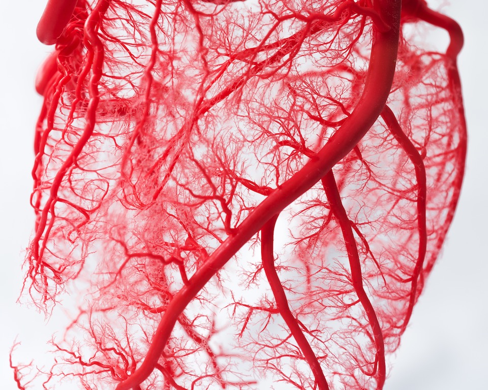 If You Are Dealing With Clogged Arteries Read This