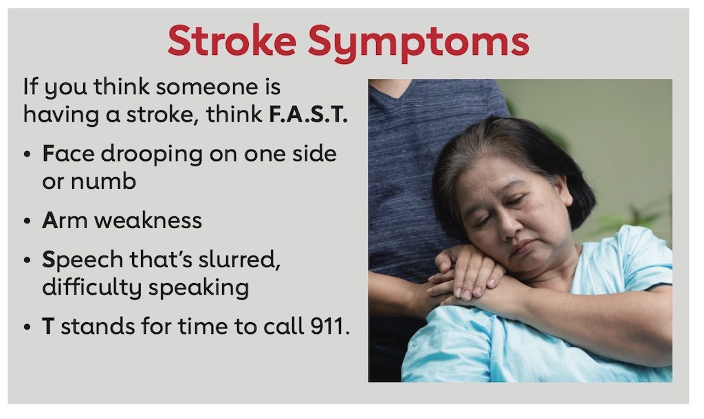 Stroke Symptoms 