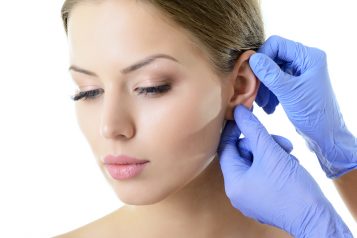 ear reshaping surgery