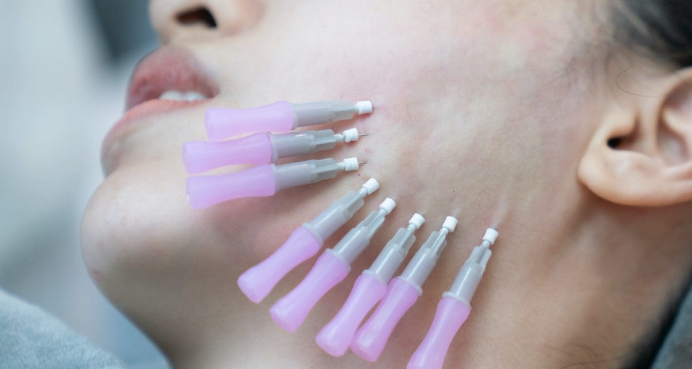 Your Guide To PDO Threads