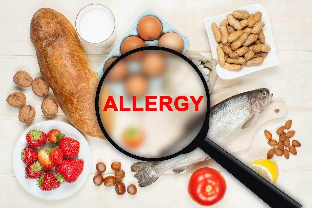 food allergy