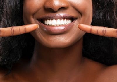 teeth whitening