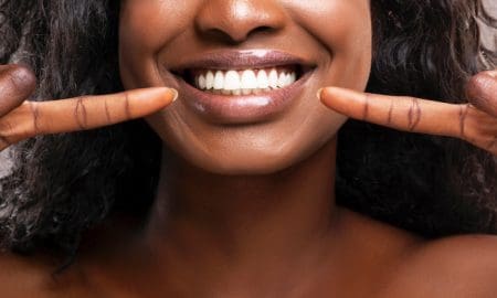 teeth whitening