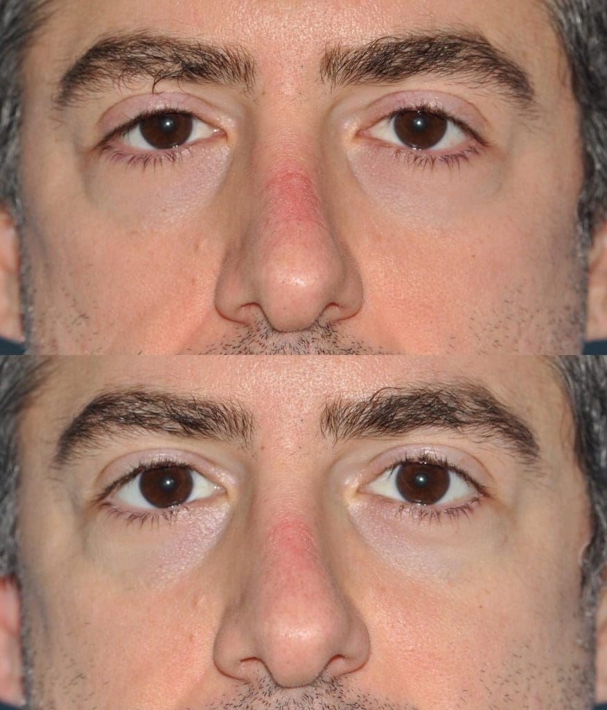 A Unique Eye Drop For Adults Designed To Enhance And Open Your Eyes