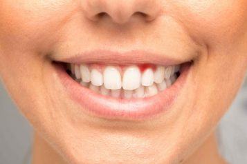 Preserve The Health Of Your Gums With These Periodontal Procedures