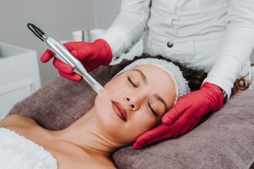 Beautiful,Woman,Receiving,Microneedling,Rejuvenation,Treatment.,Mesotherapy.