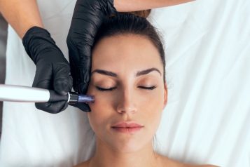 The In’s And Out’s Of Microneedling