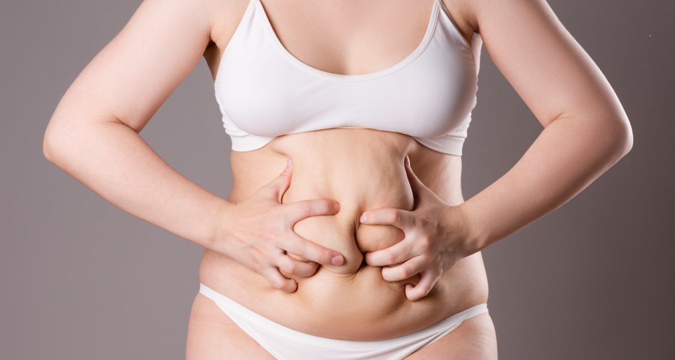 Tummy Tuck Recovery Tips: Things Needed For Healing Process, 45% OFF