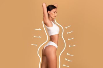 Liposuction,Concept.,Drawn,Outlines,With,Arrows,Around,Fit,Lady,In
