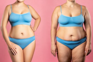 Woman’s,Body,Before,And,After,Weight,Loss,On,Pink,Background,