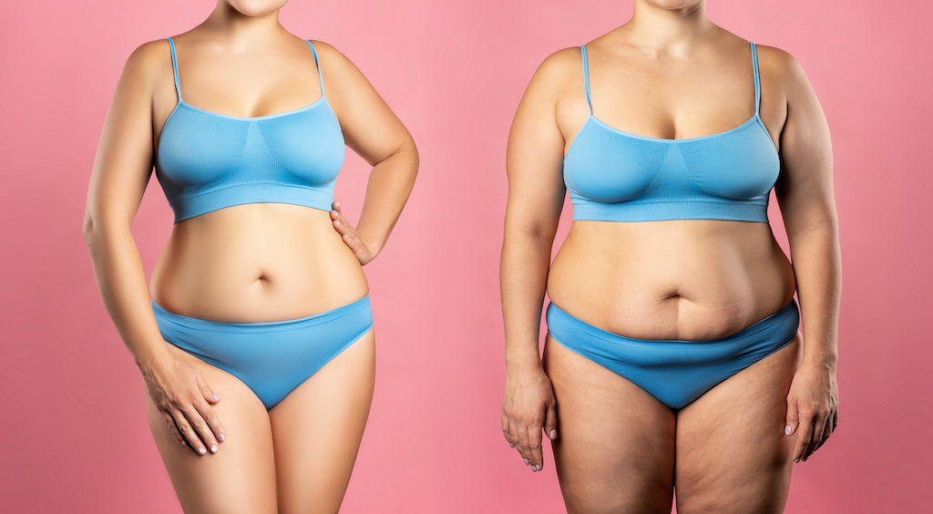 It’s Time To Bid Farewell To Unwanted Belly Fat With A Tummy Tuck Transformation