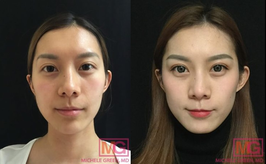 Cheekbone Beauty: When Transformation Is Part of the Journey