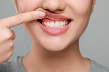 Recognizing The Signs Of Gum Disease: What To Watch For