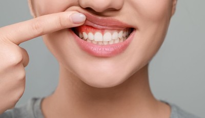 Recognizing The Signs Of Gum Disease: What To Watch For