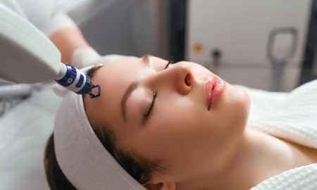 VBeam Laser Technology