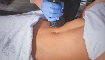 coolsculpting method