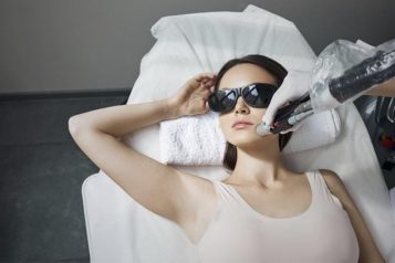 model posing during hair removal