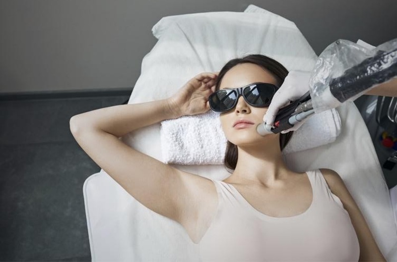 model posing during hair removal