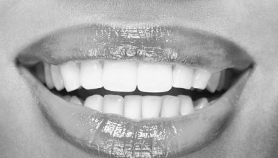 missing teeth, tmj problems, dental implants, oral health, tooth replacement