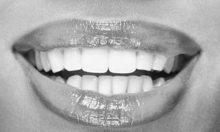 missing teeth, tmj problems, dental implants, oral health, tooth replacement