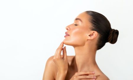 model side pose - deep plane facelift