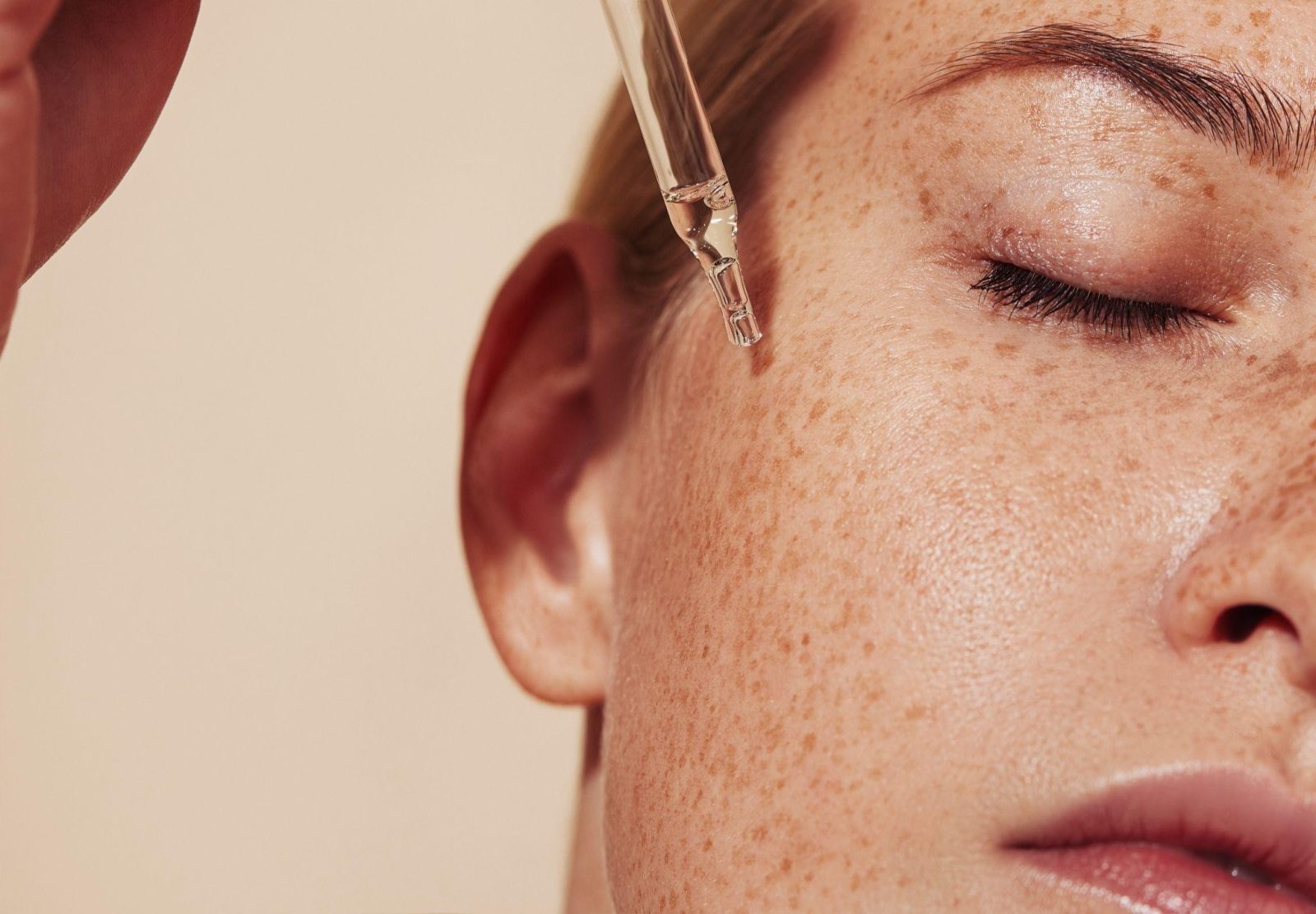 Spring Reset: Why IPL Is the Ultimate Skin Refresh
