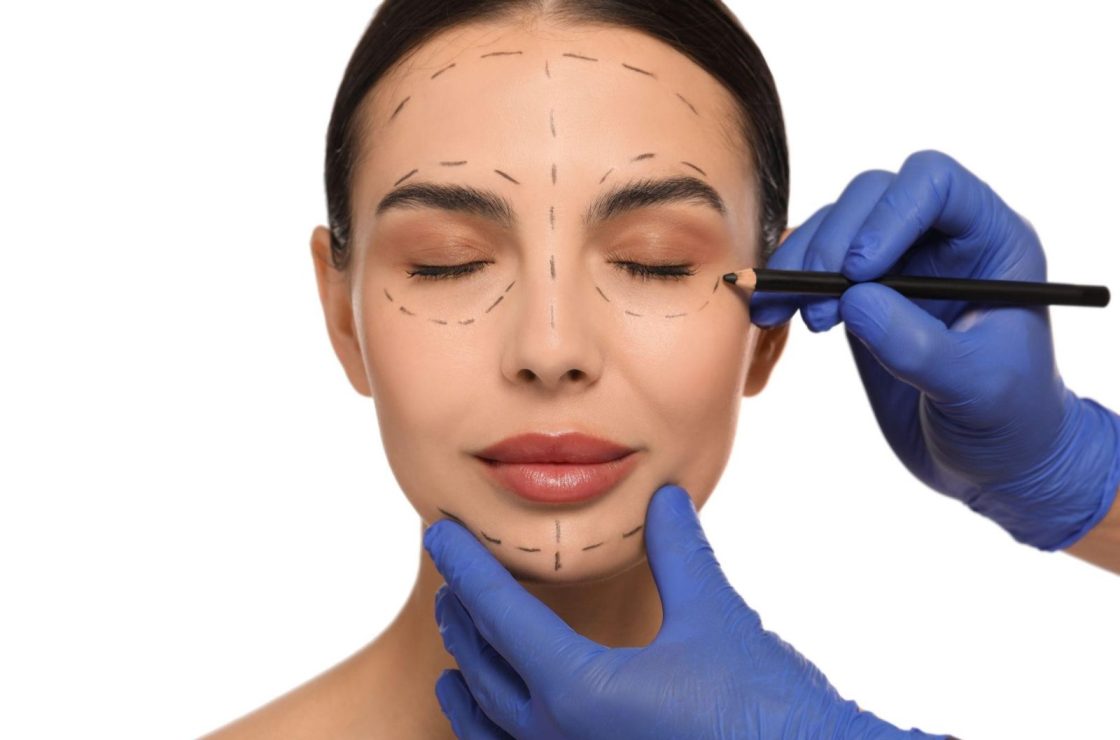 facelifts procedure concept
