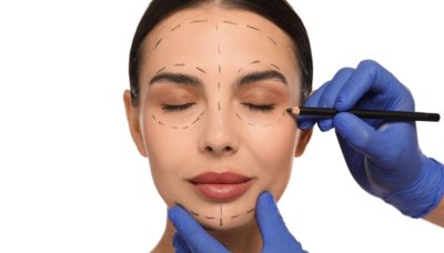 facelifts procedure concept