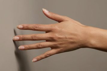 Fat Grafting to the Hands