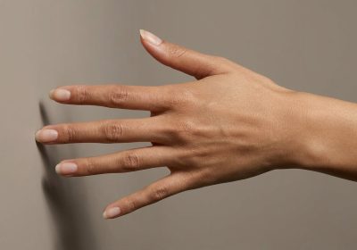 Fat Grafting to the Hands