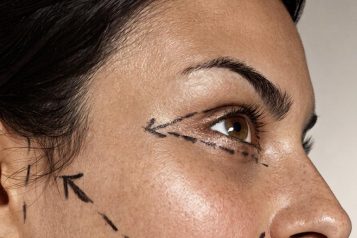 Global Facelift Expert