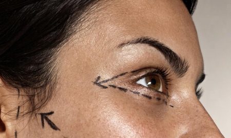 Global Facelift Expert - deep plane facelift