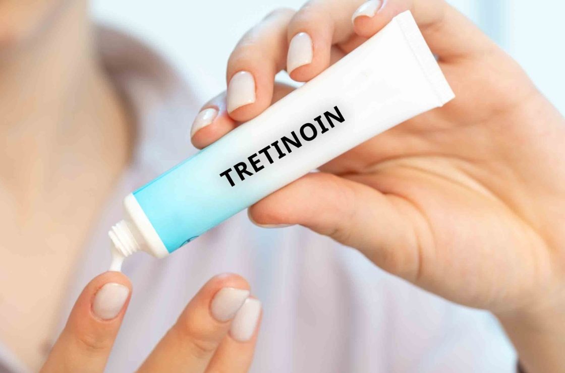 tretinoin for acne, acne treatment, retinoids, skincare routine, acne skincare