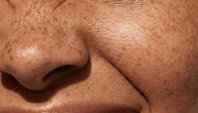 women smile closeup - TMJ treatment