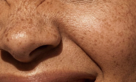 women smile closeup - TMJ treatment