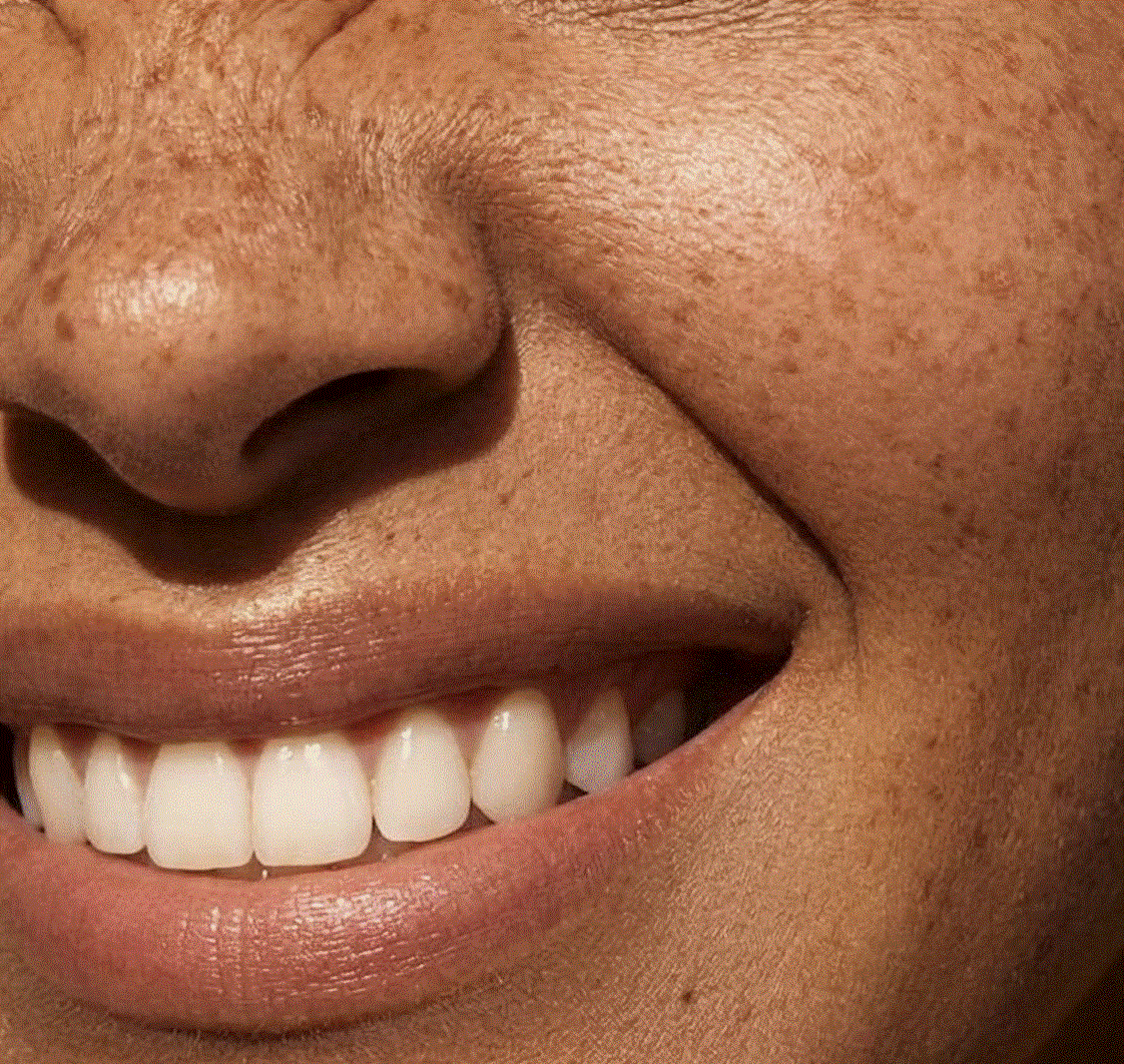 TMJ Relief: The Root of Jaw Pain and How to Treat It Effectively