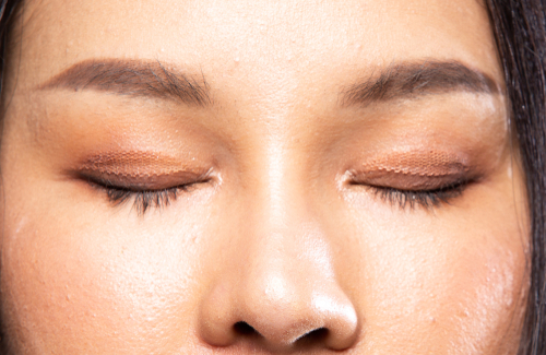The Dangers of DIY Eye Tape and Filler Trends: A Surgeon’s Perspective