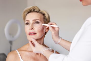 Closeup,Of,Mature,Woman,With,Face,Contour,Lines,During,Anti-aging