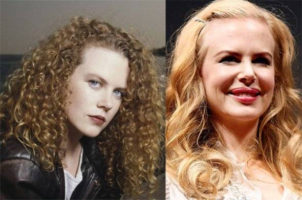 Celebrities: Before and After Plastic Surgery - Haute Living