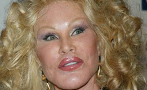 Bride of Wildenstein