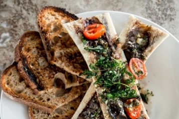 bone marrow PerDiem_011