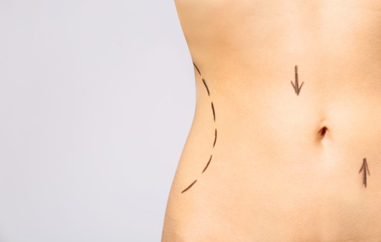 CoolSculpting® New York City’s Go-To For Body Contouring